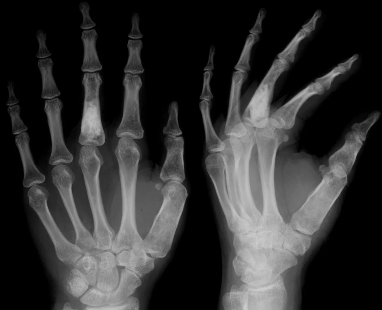 Bone & joint disease radiograph for self-assessment