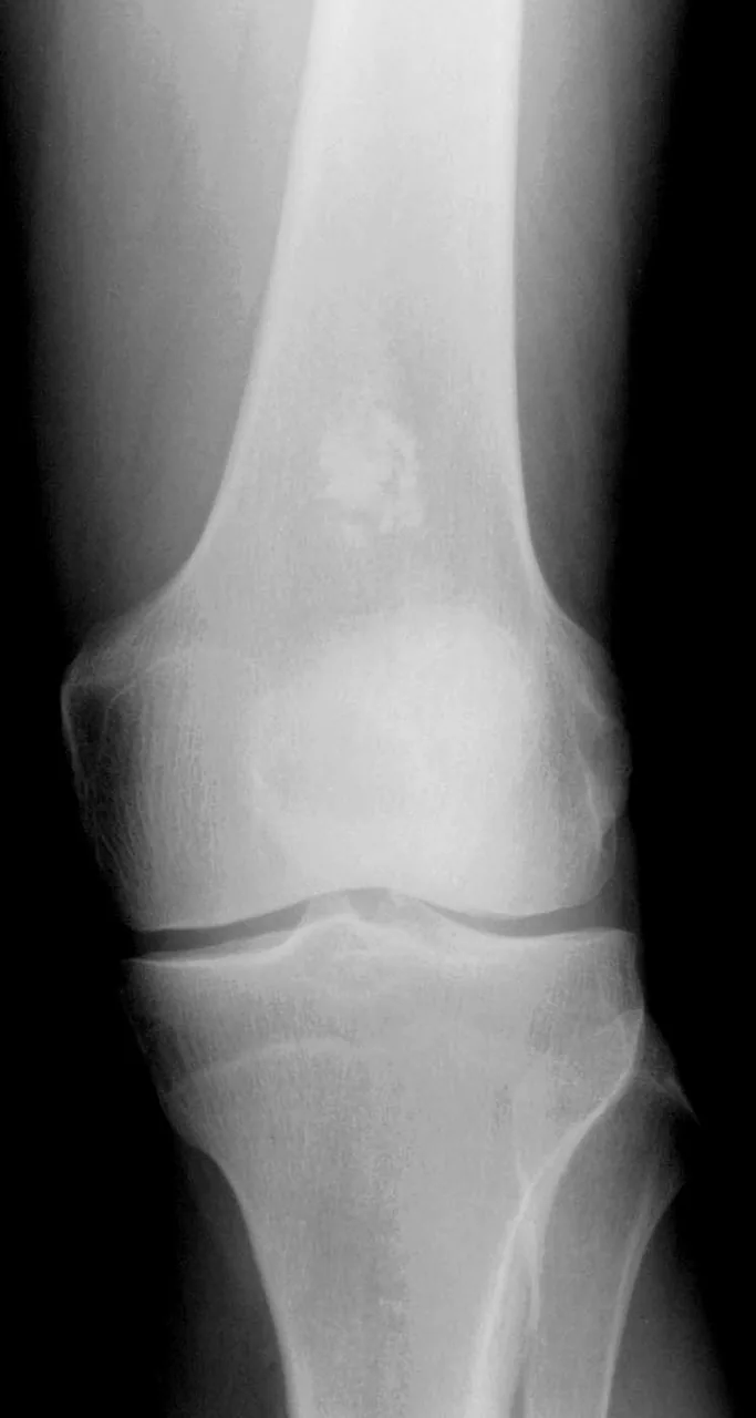 Bone & joint disease radiograph for self-assessment