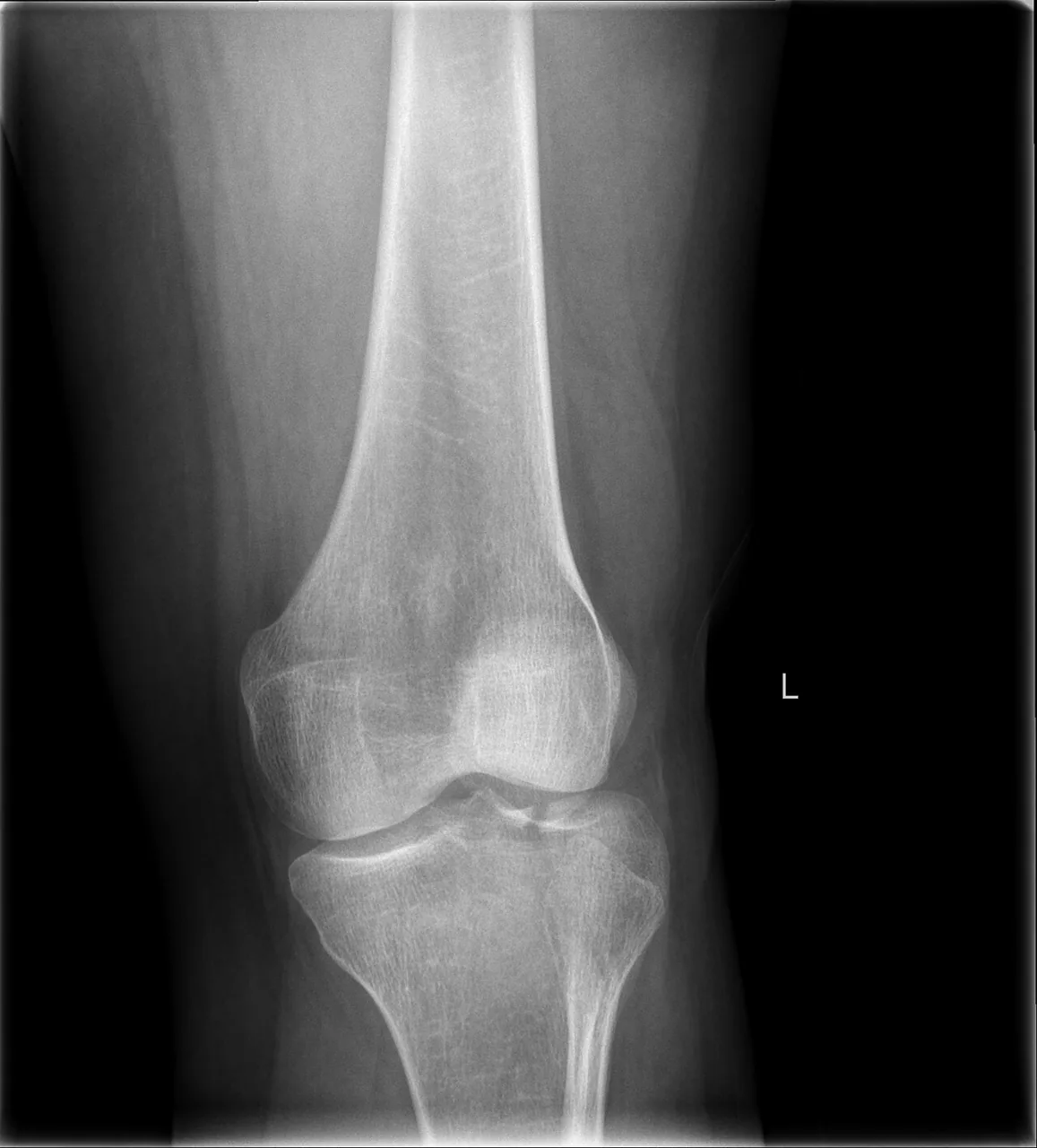 Lower limb radiograph for self-assessment