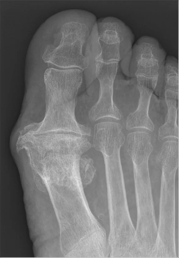 Bone & joint disease radiograph for self-assessment