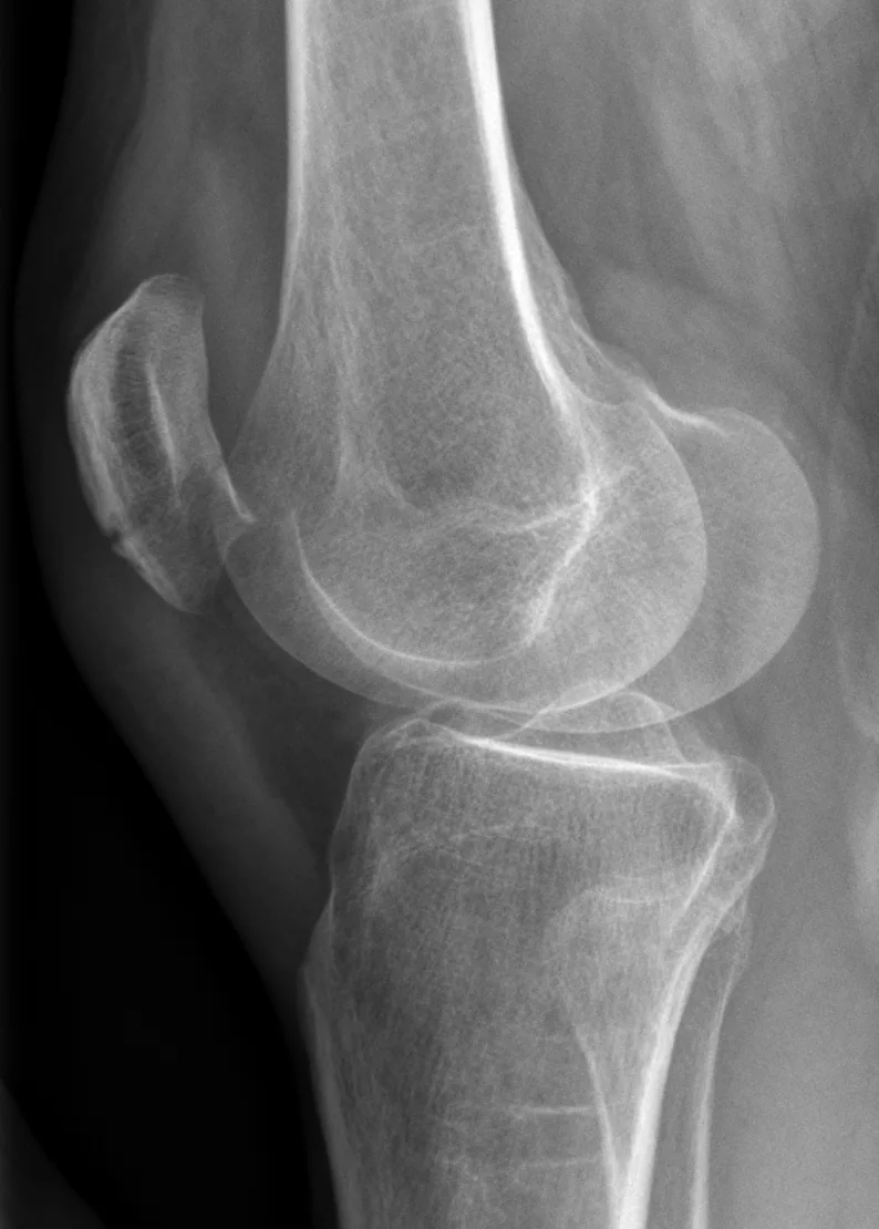 Lower limb radiograph for self-assessment