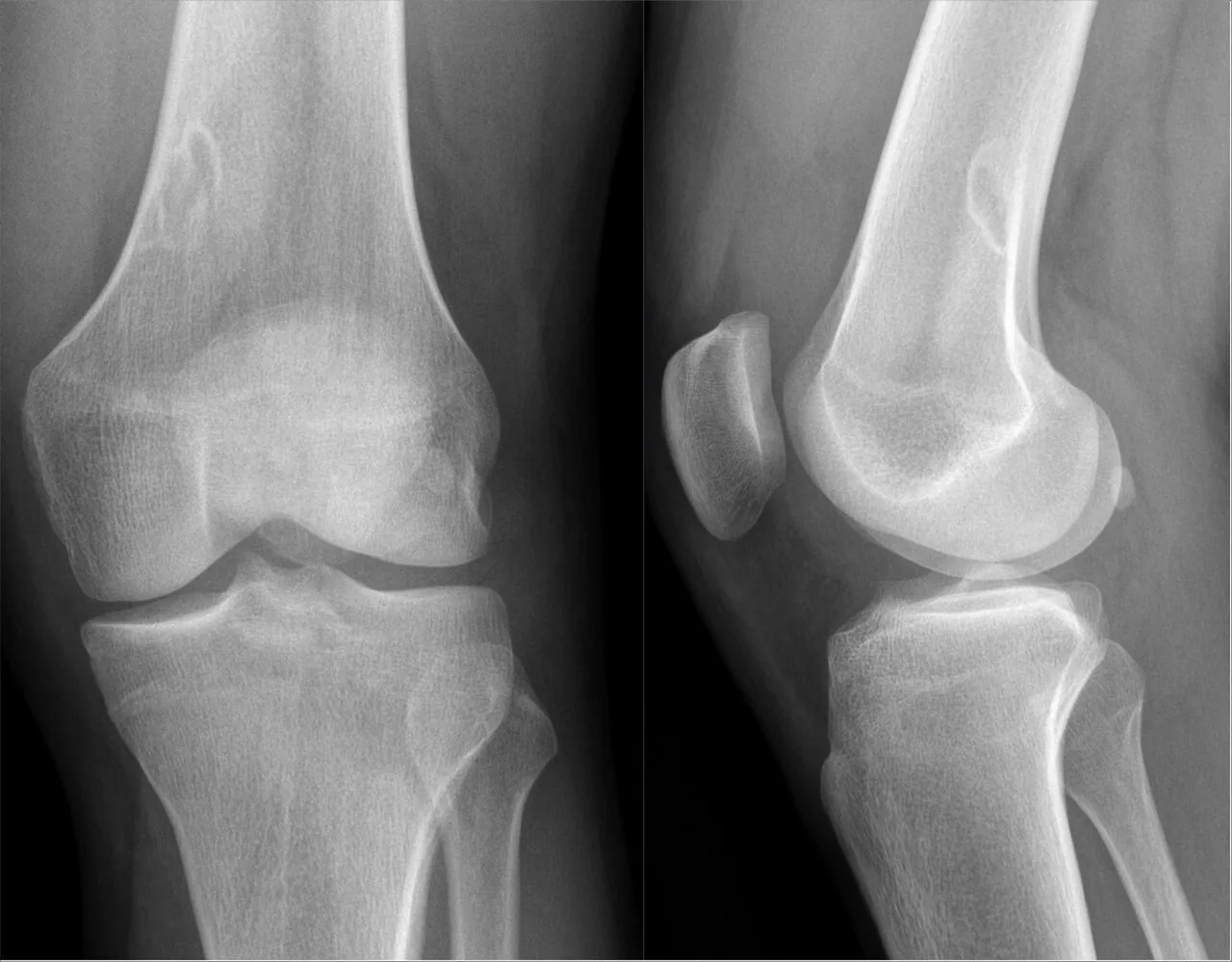 Bone & joint disease radiograph for self-assessment