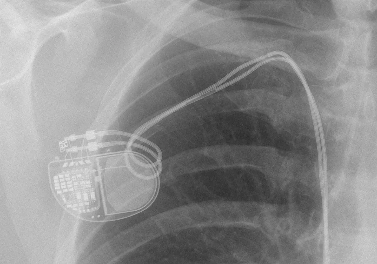Lines & tubes radiograph for self-assessment