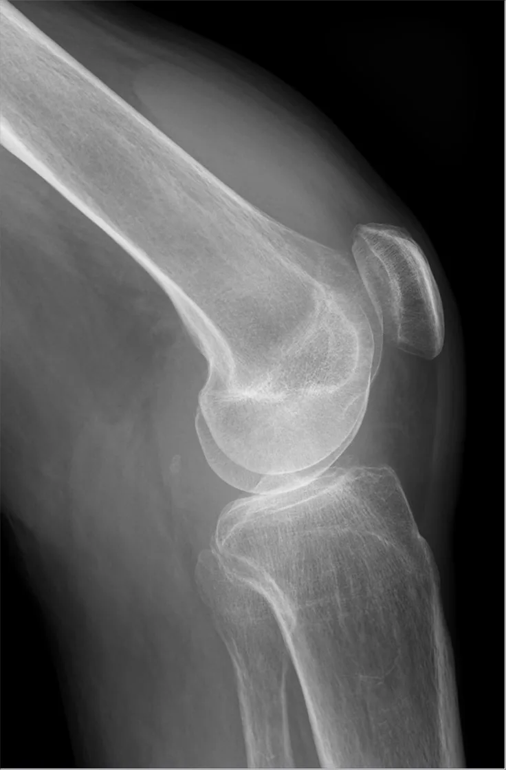 Lower limb radiograph for self-assessment