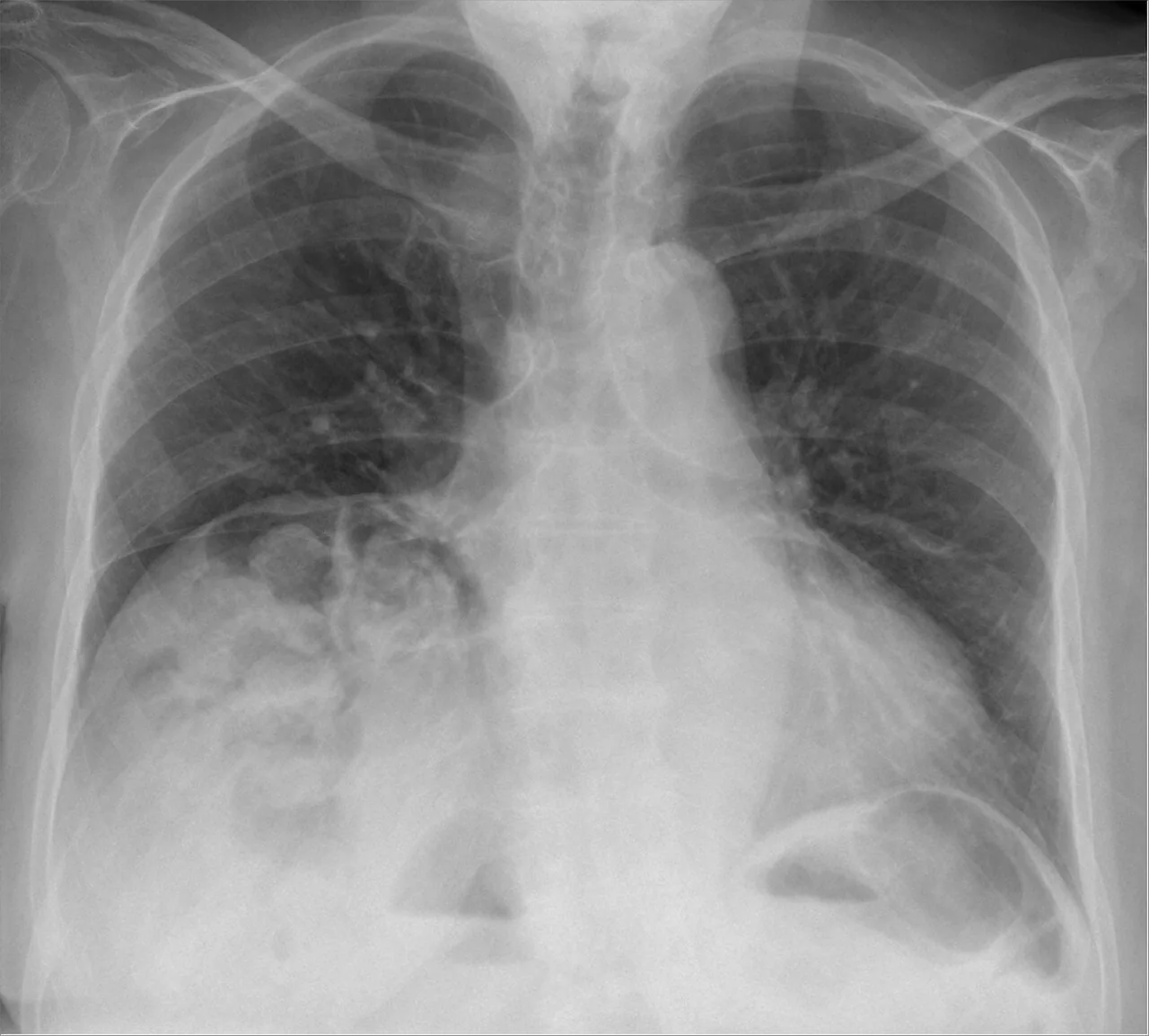 Abdomen radiograph for self-assessment