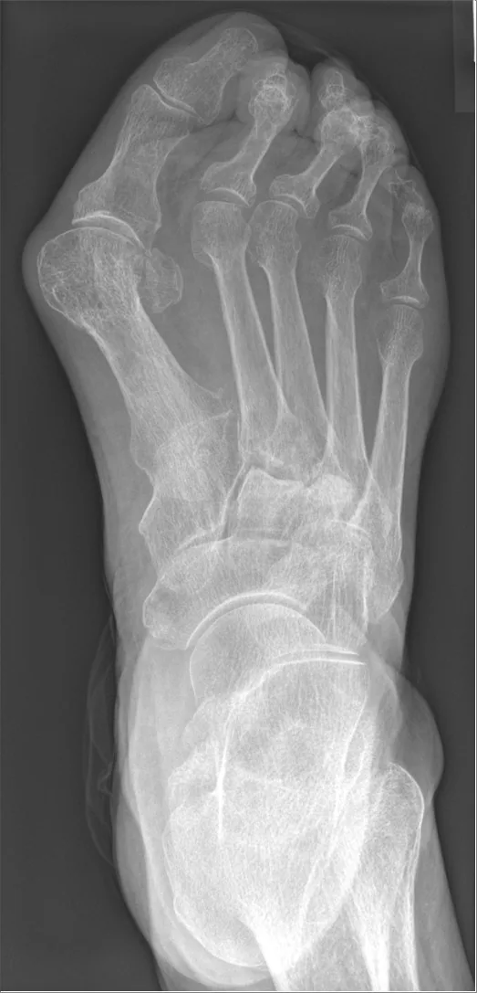 Bone & joint disease radiograph for self-assessment