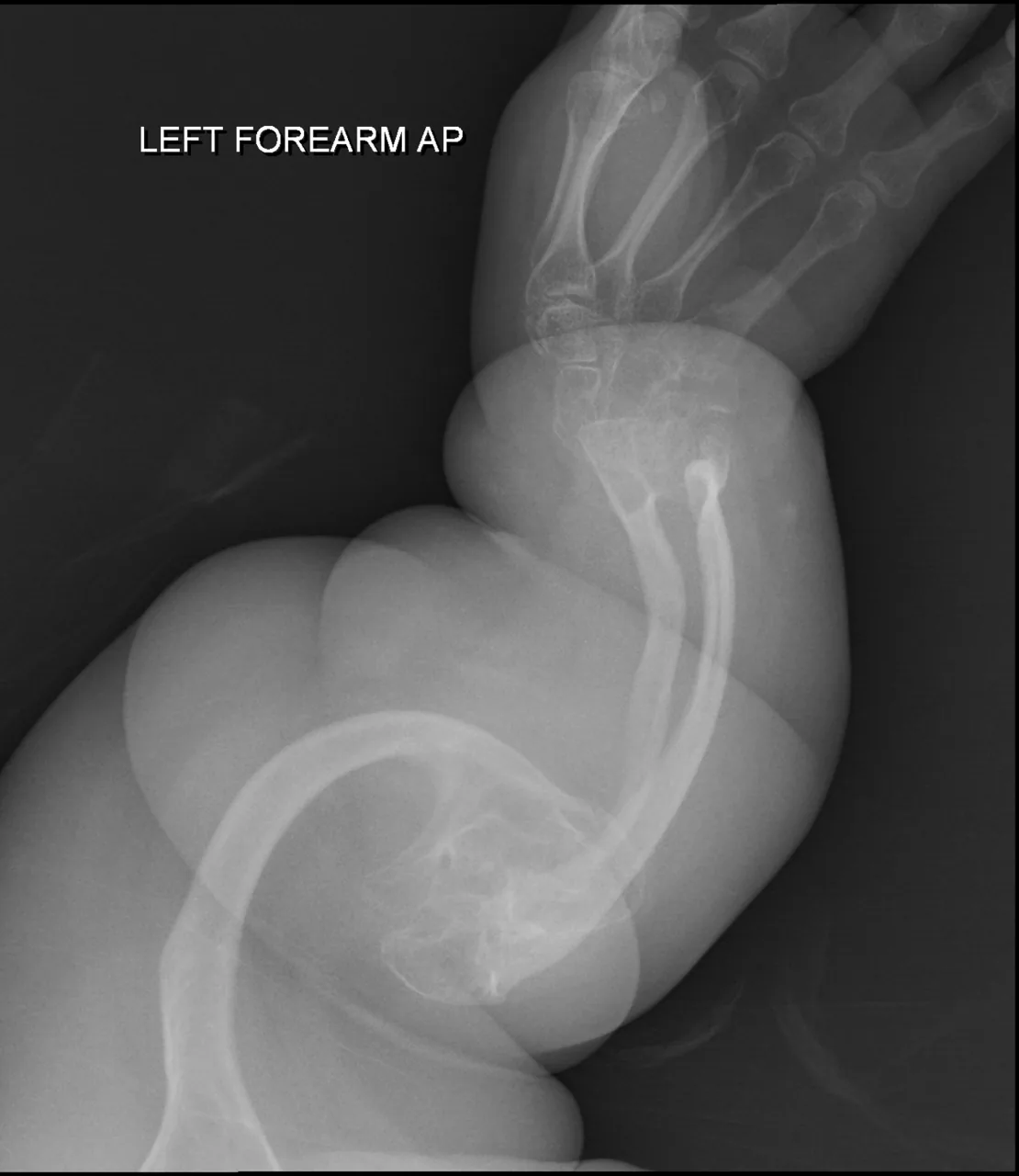Paediatric radiograph for self-assessment