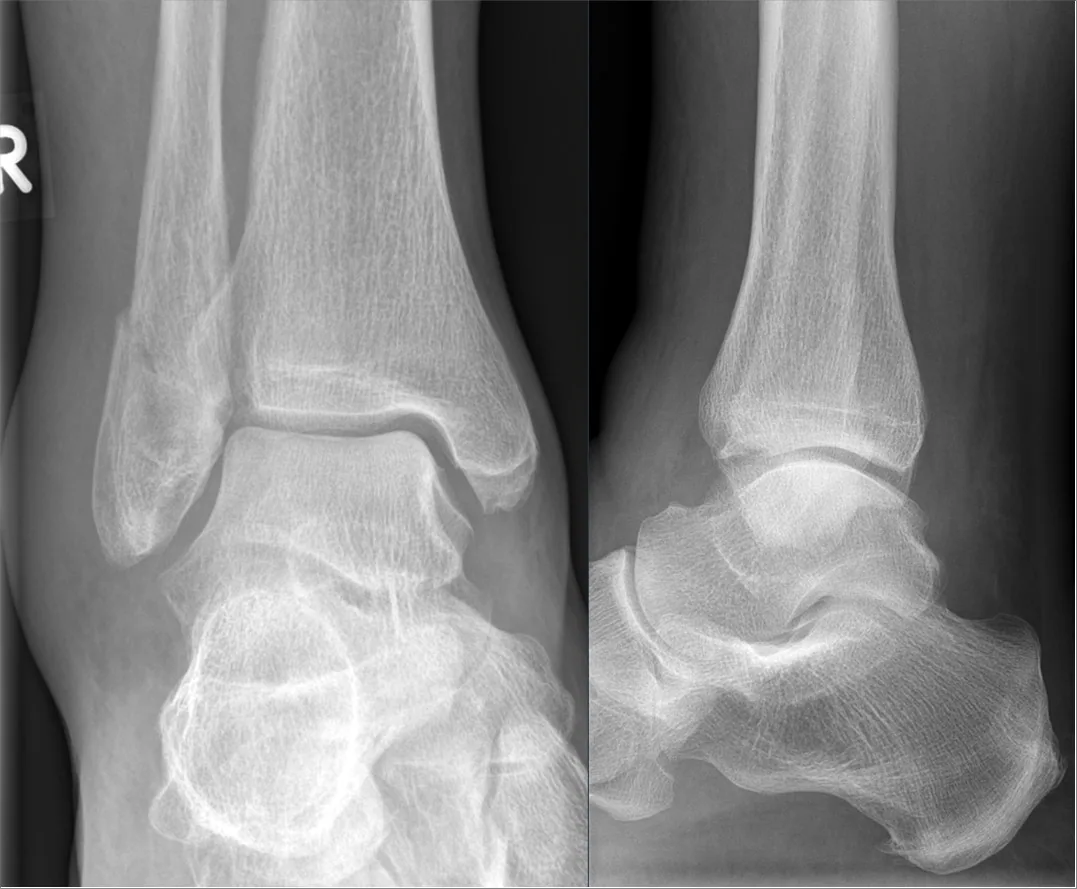 Lower limb radiograph for self-assessment