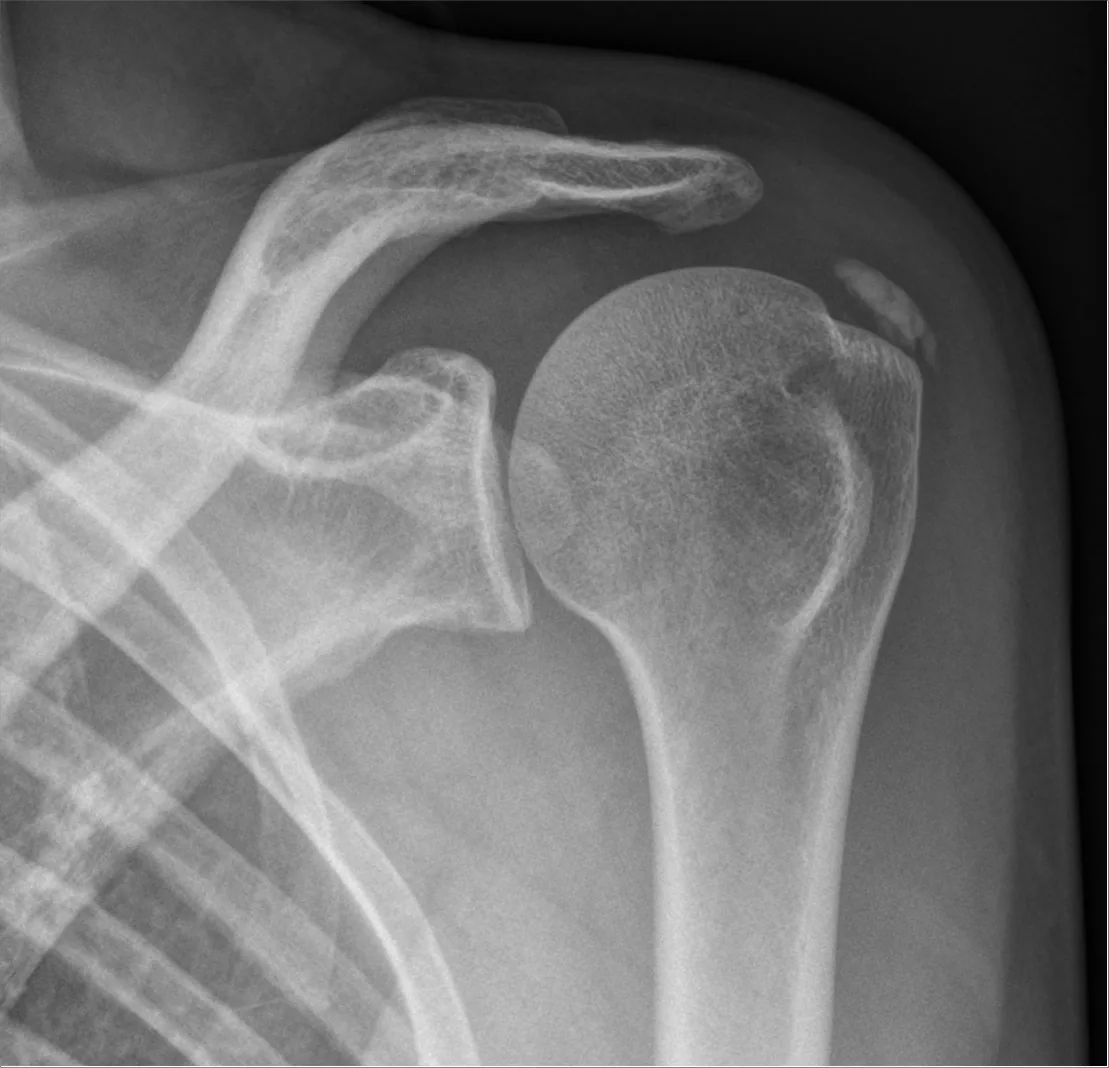 Upper limb radiograph for self-assessment