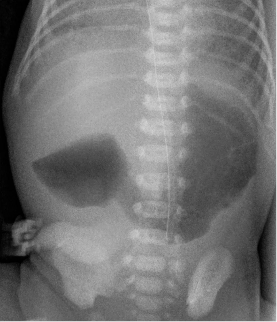 Paediatric radiograph for self-assessment