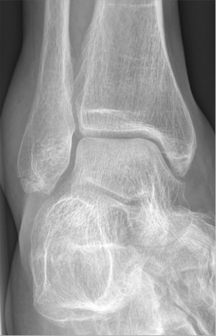 Lower limb radiograph for self-assessment