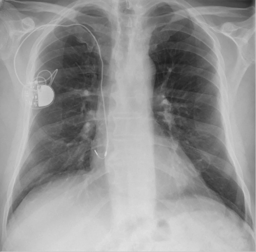 Lines & tubes radiograph for self-assessment