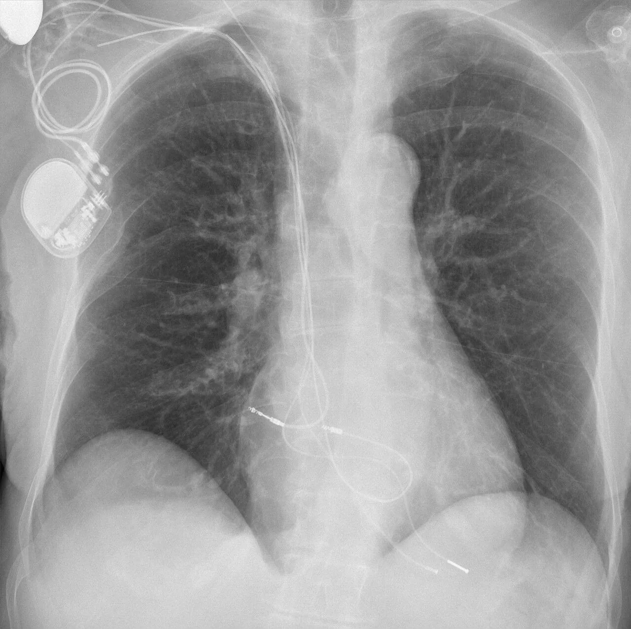 Lines & tubes radiograph for self-assessment