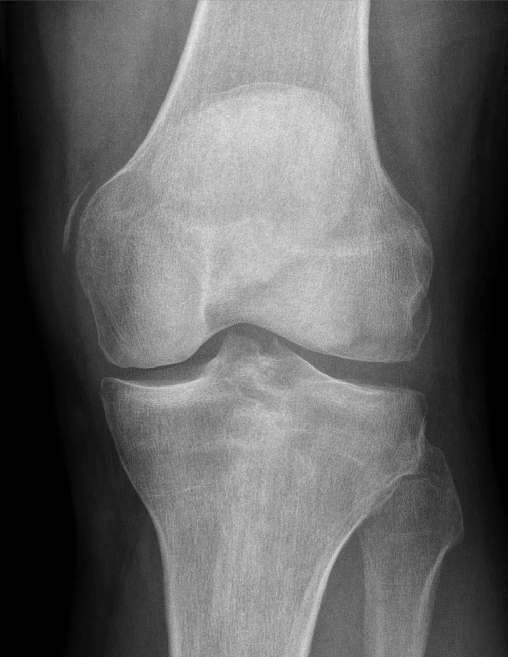 Lower limb radiograph for self-assessment