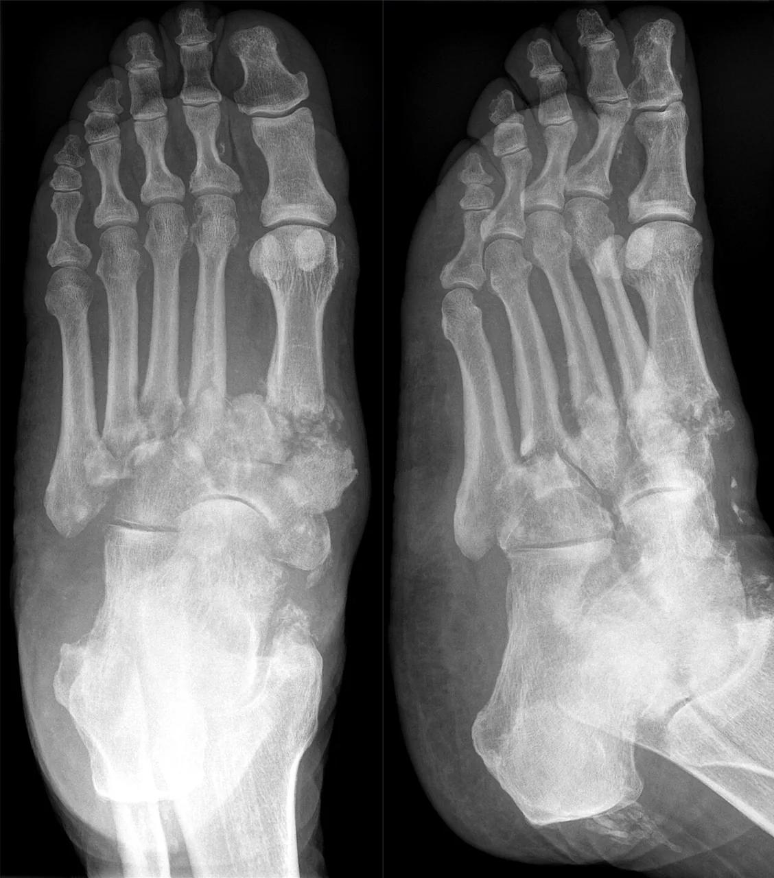 Bone & joint disease radiograph for self-assessment