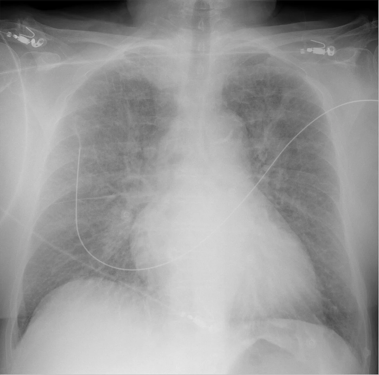 Chest radiograph for self-assessment
