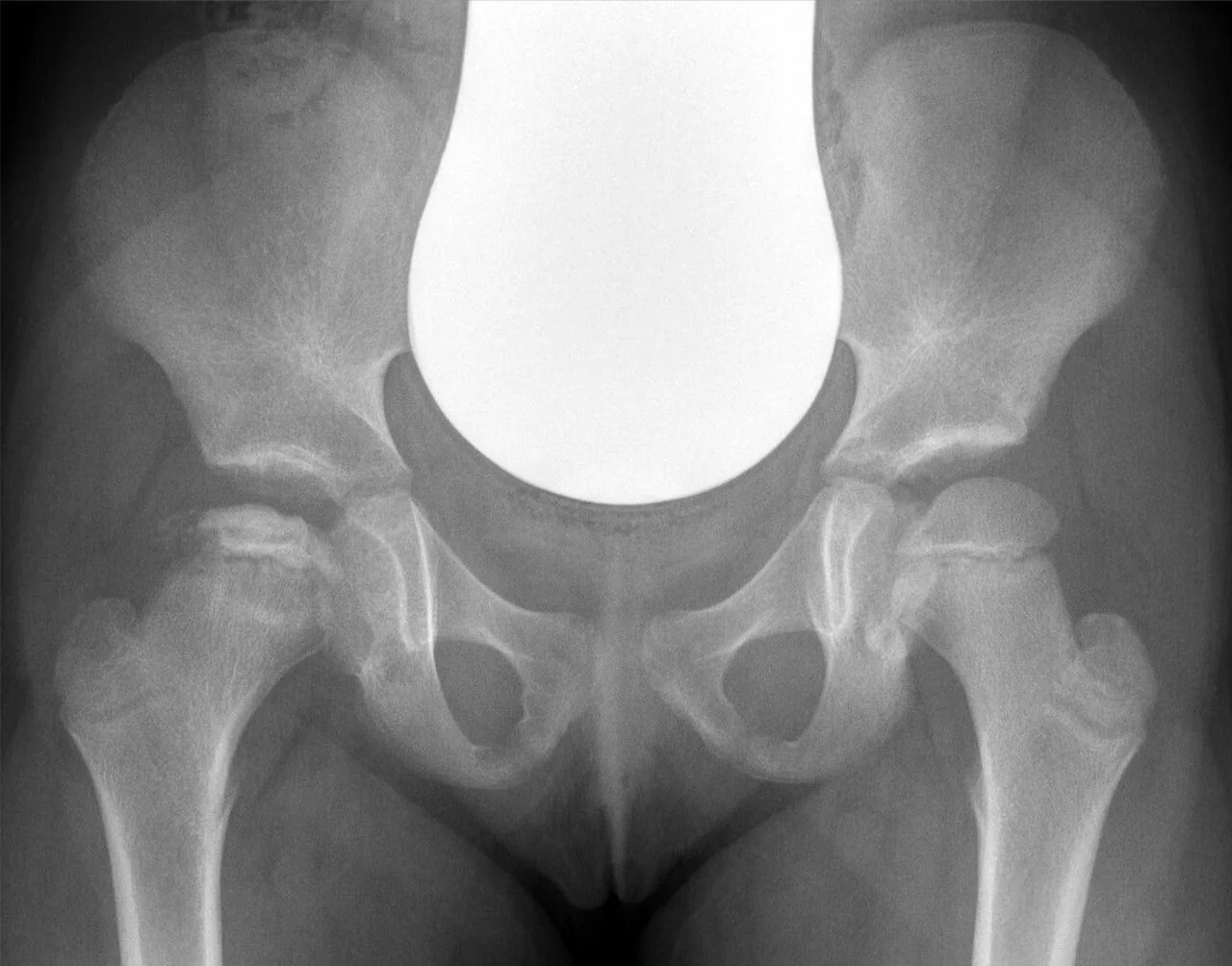 Paediatric radiograph for self-assessment