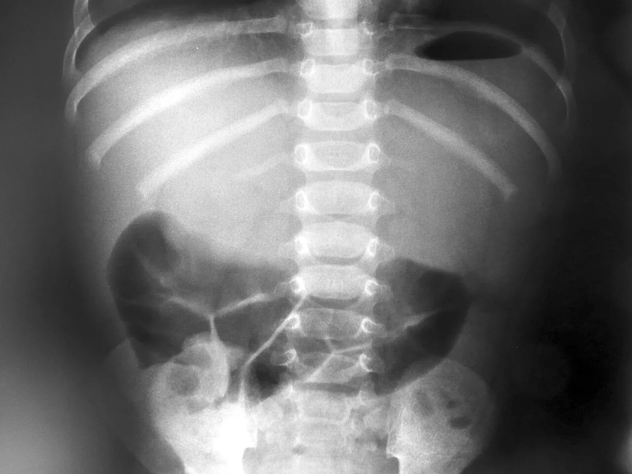 Abdomen radiograph for self-assessment
