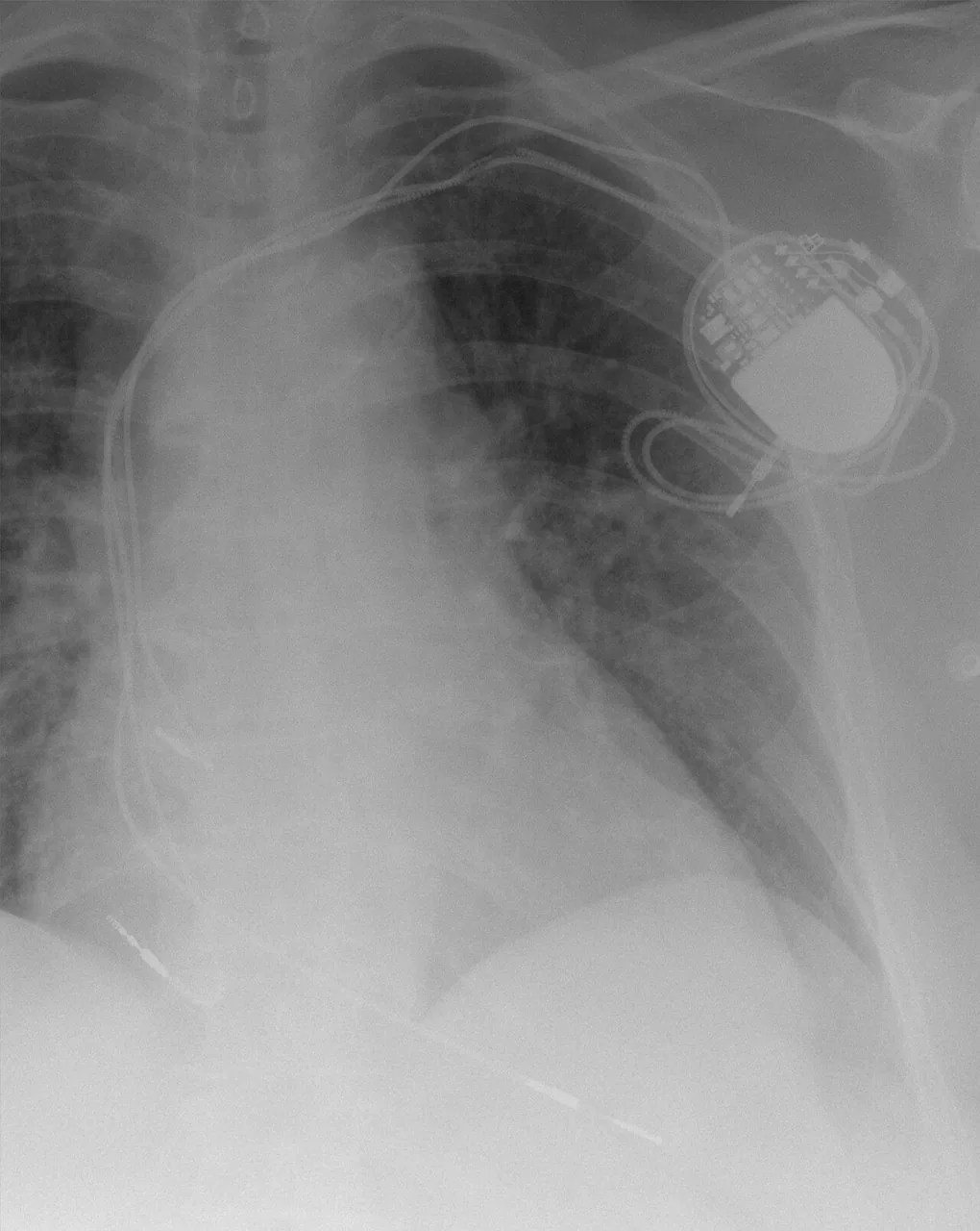 Lines & tubes radiograph for self-assessment