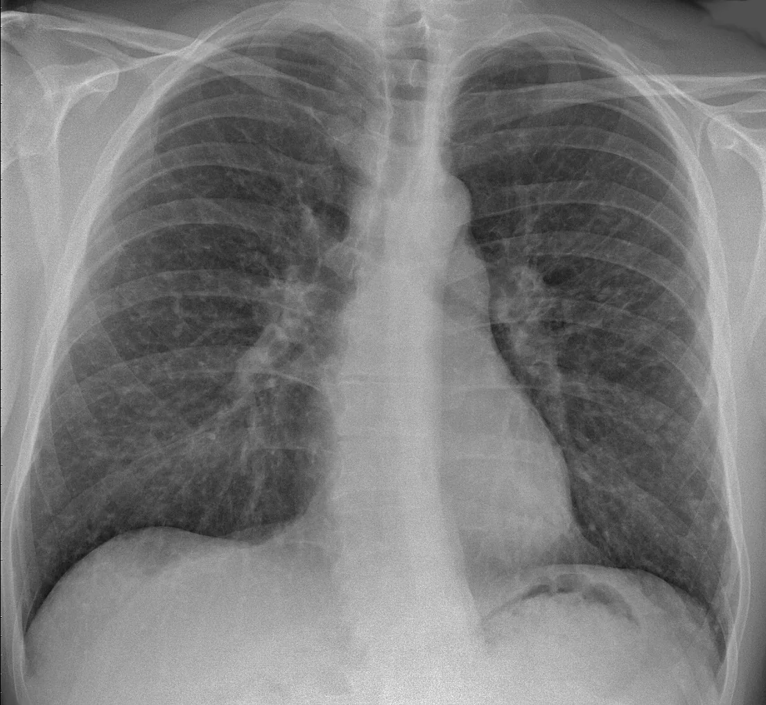 Chest radiograph for self-assessment
