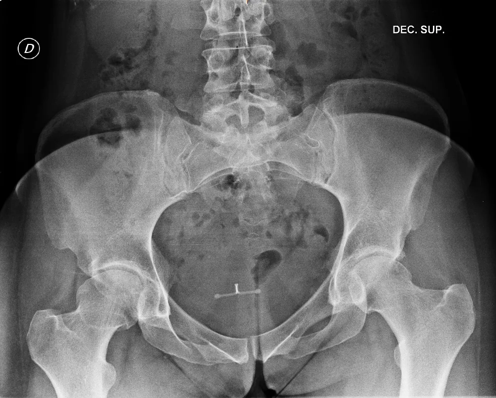 Abdomen radiograph for self-assessment