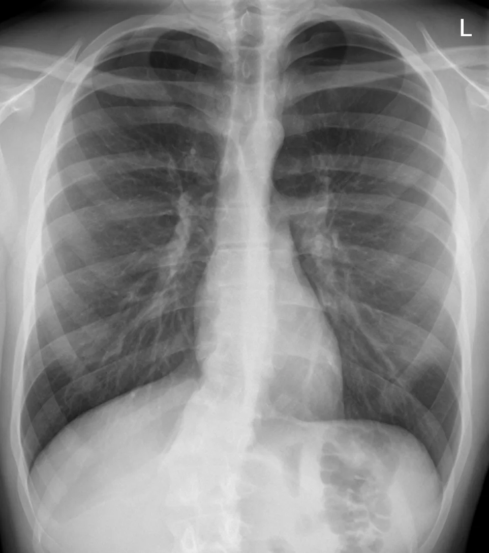 Chest radiograph for self-assessment