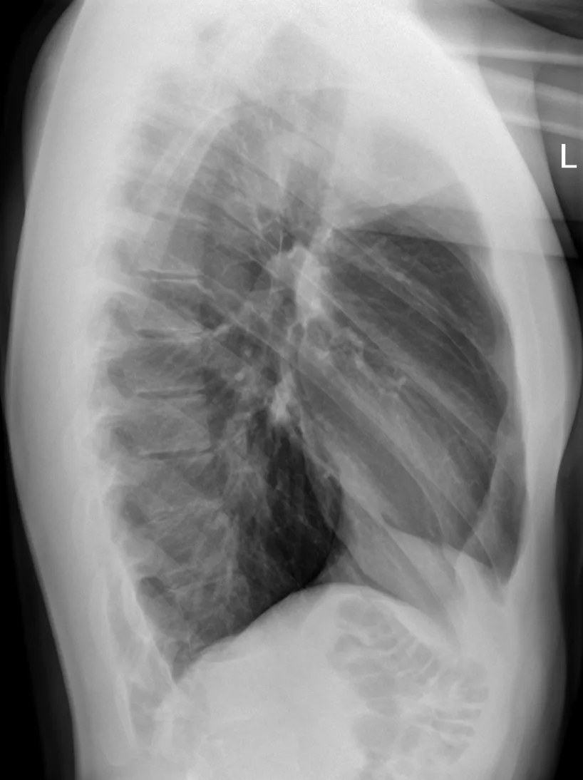 Chest radiograph for self-assessment