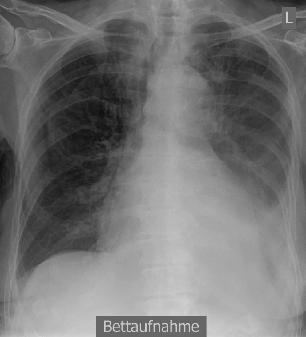 Chest radiograph for self-assessment