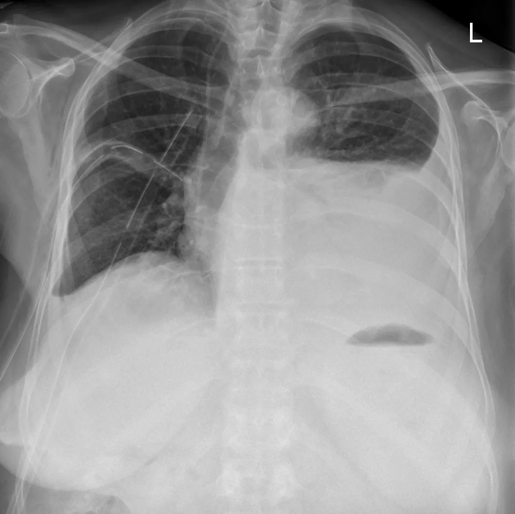 Chest radiograph for self-assessment