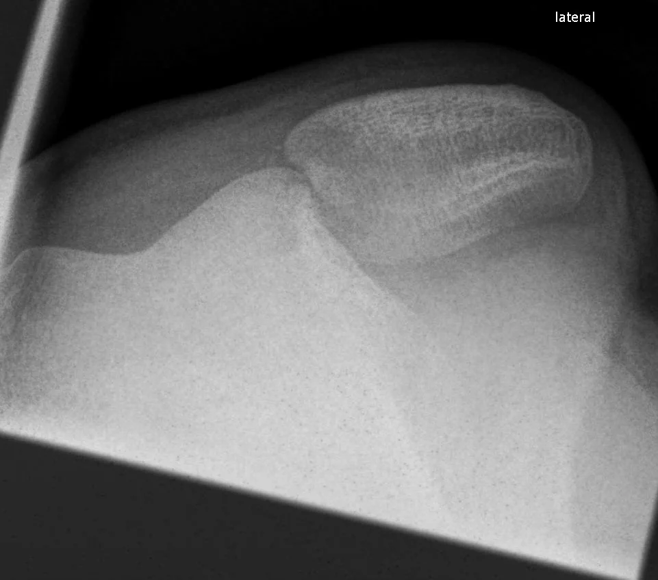 Lower limb radiograph for self-assessment