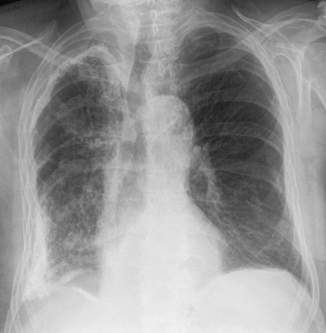 Chest radiograph for self-assessment