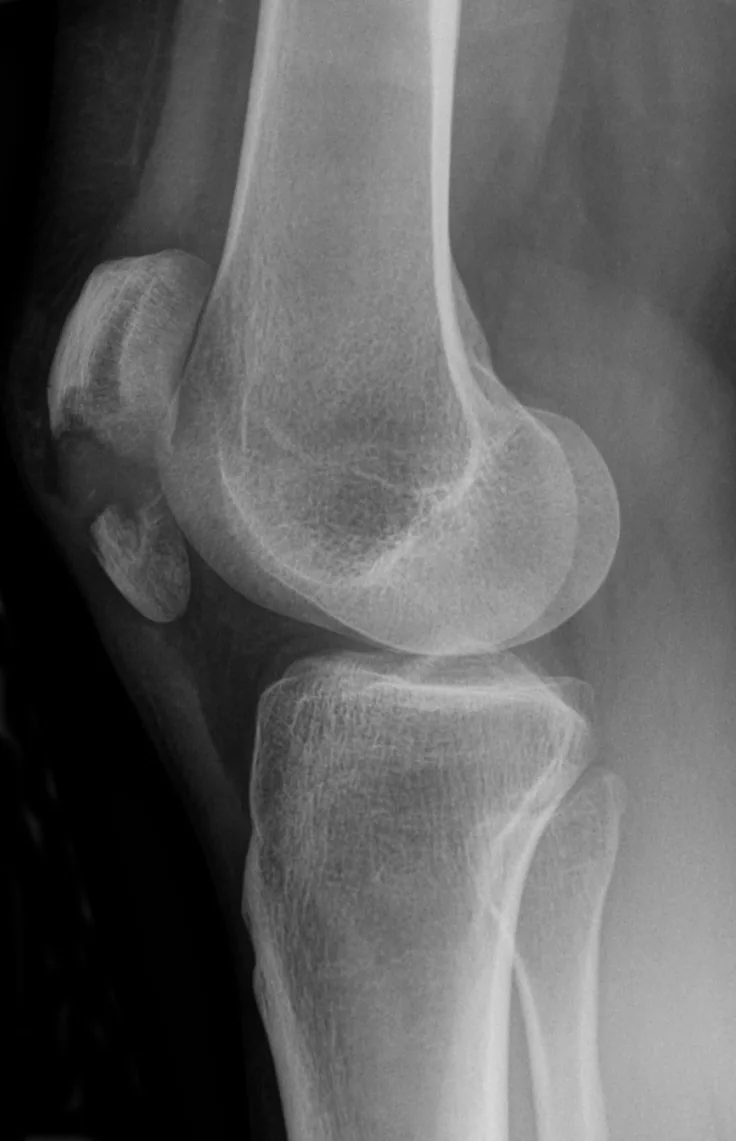 Lower limb radiograph for self-assessment