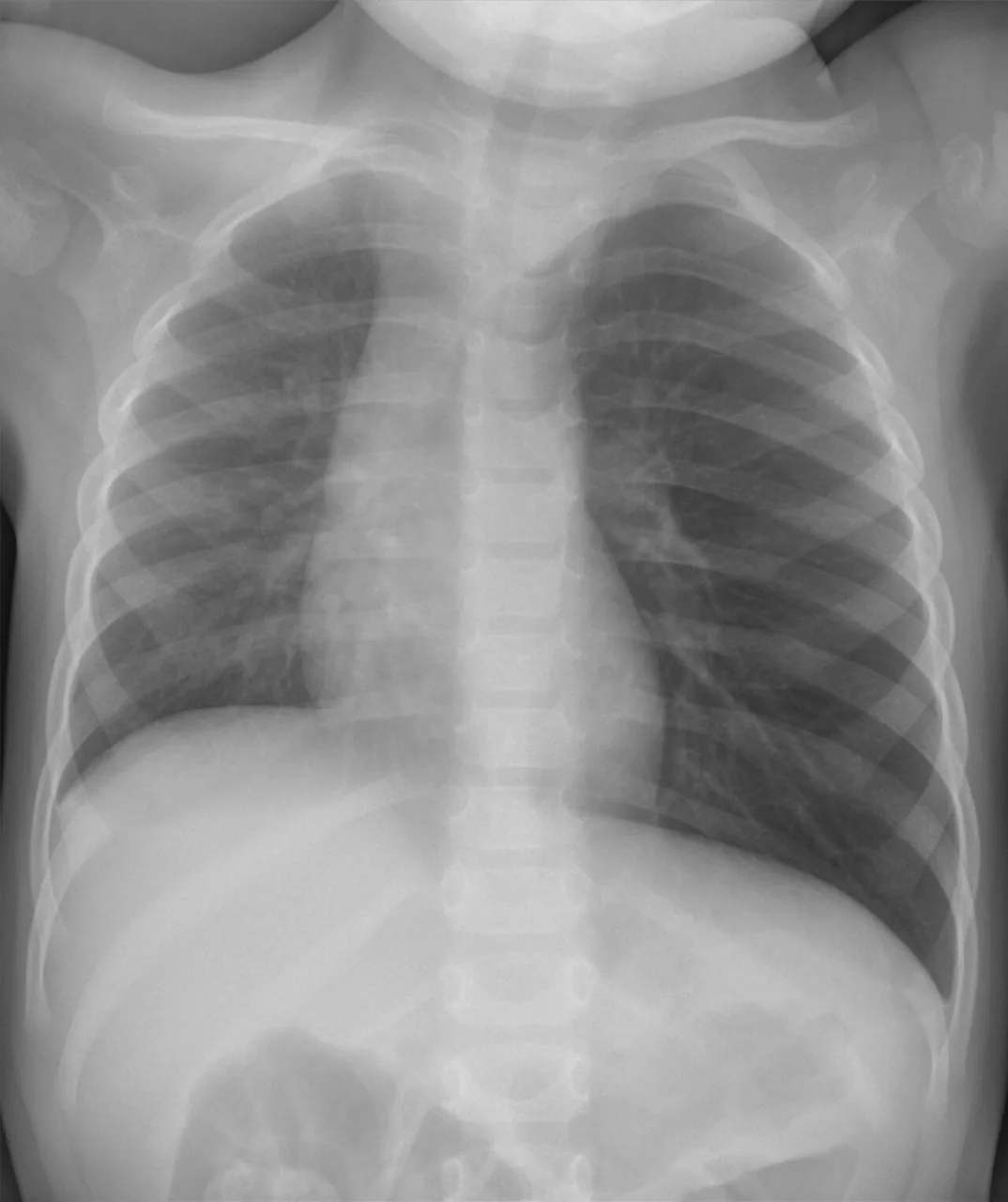 Paediatric radiograph for self-assessment