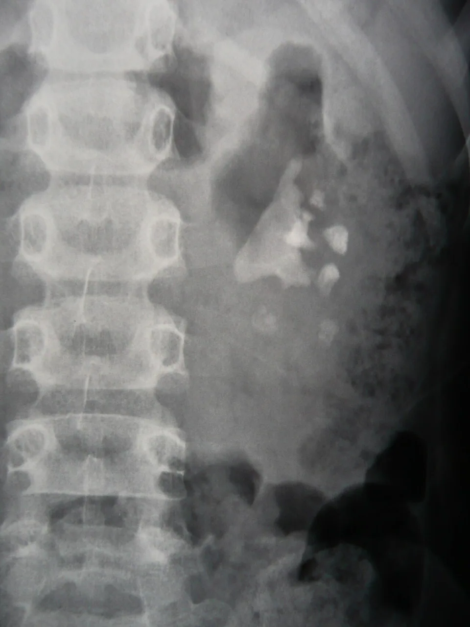 Abdomen radiograph for self-assessment