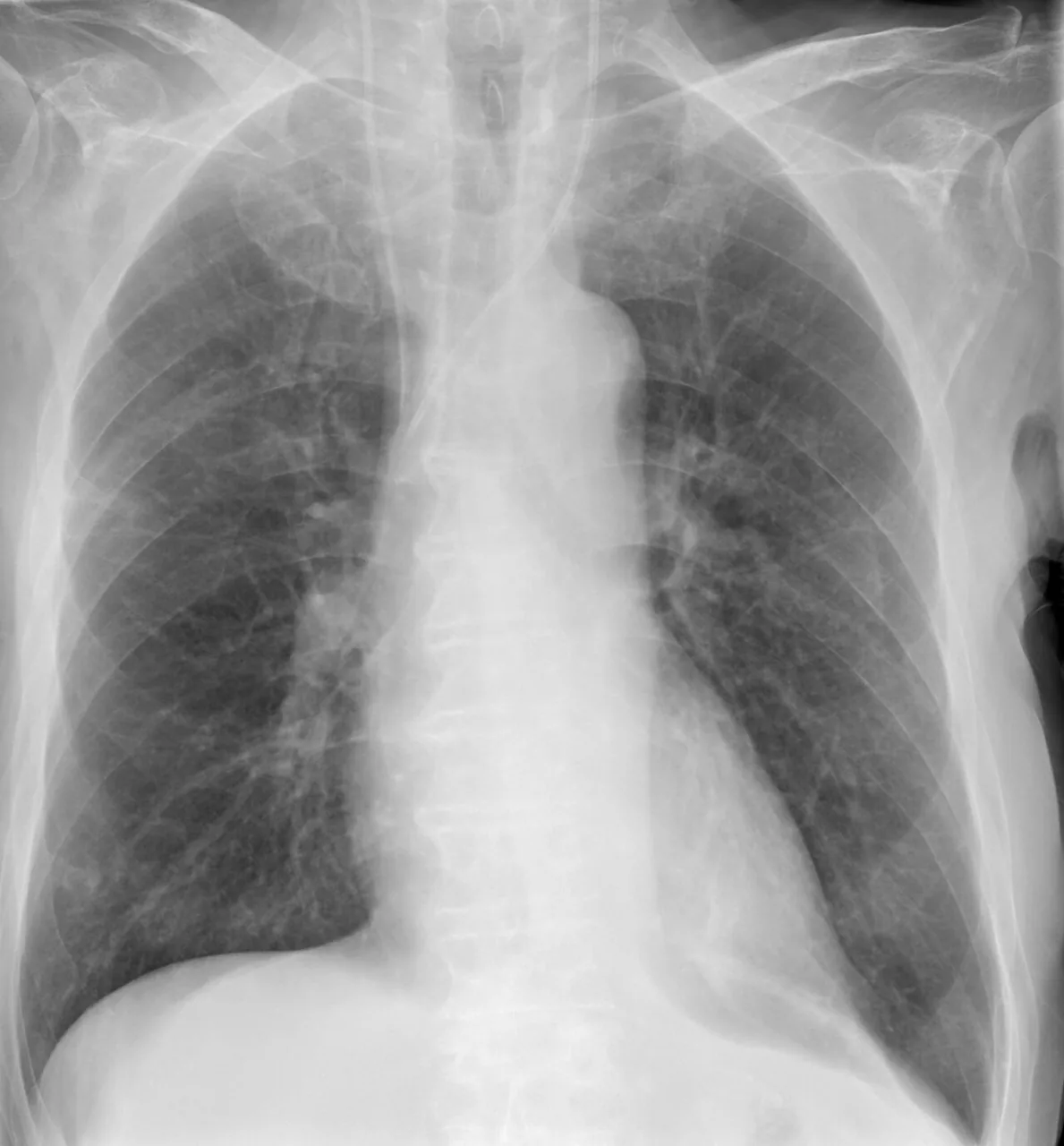 Lines & tubes radiograph for self-assessment