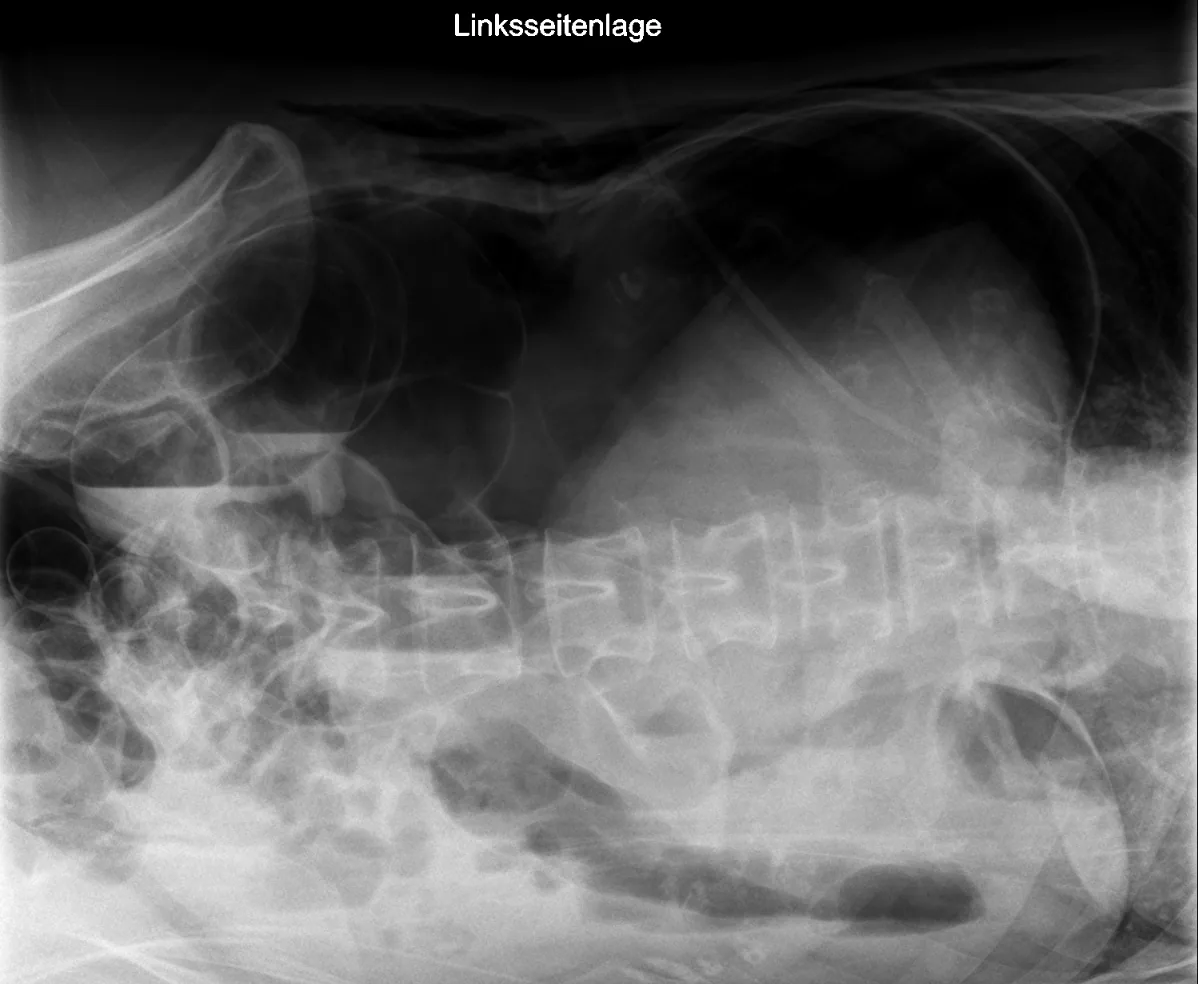 Abdomen radiograph for self-assessment