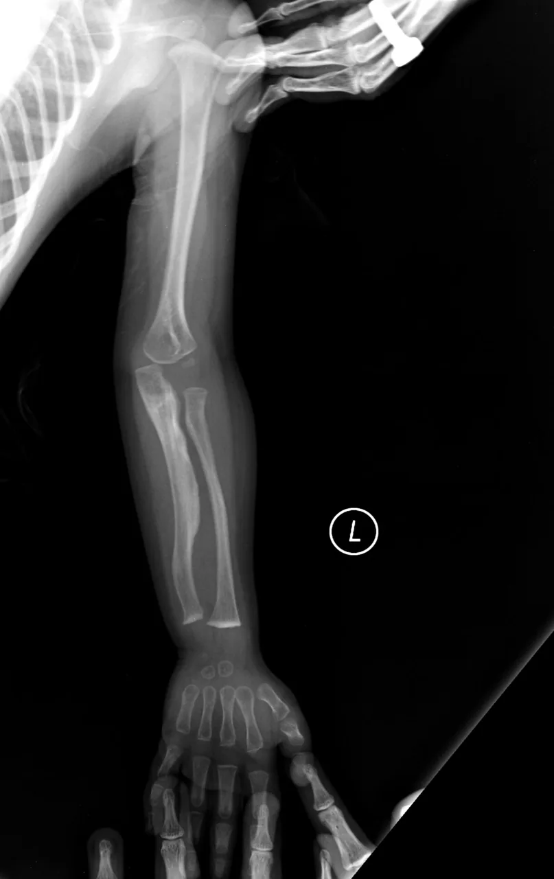 Paediatric radiograph for self-assessment