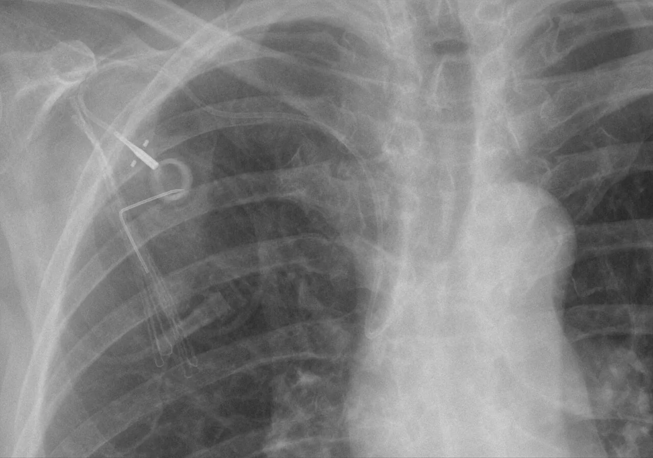 Lines & tubes radiograph for self-assessment