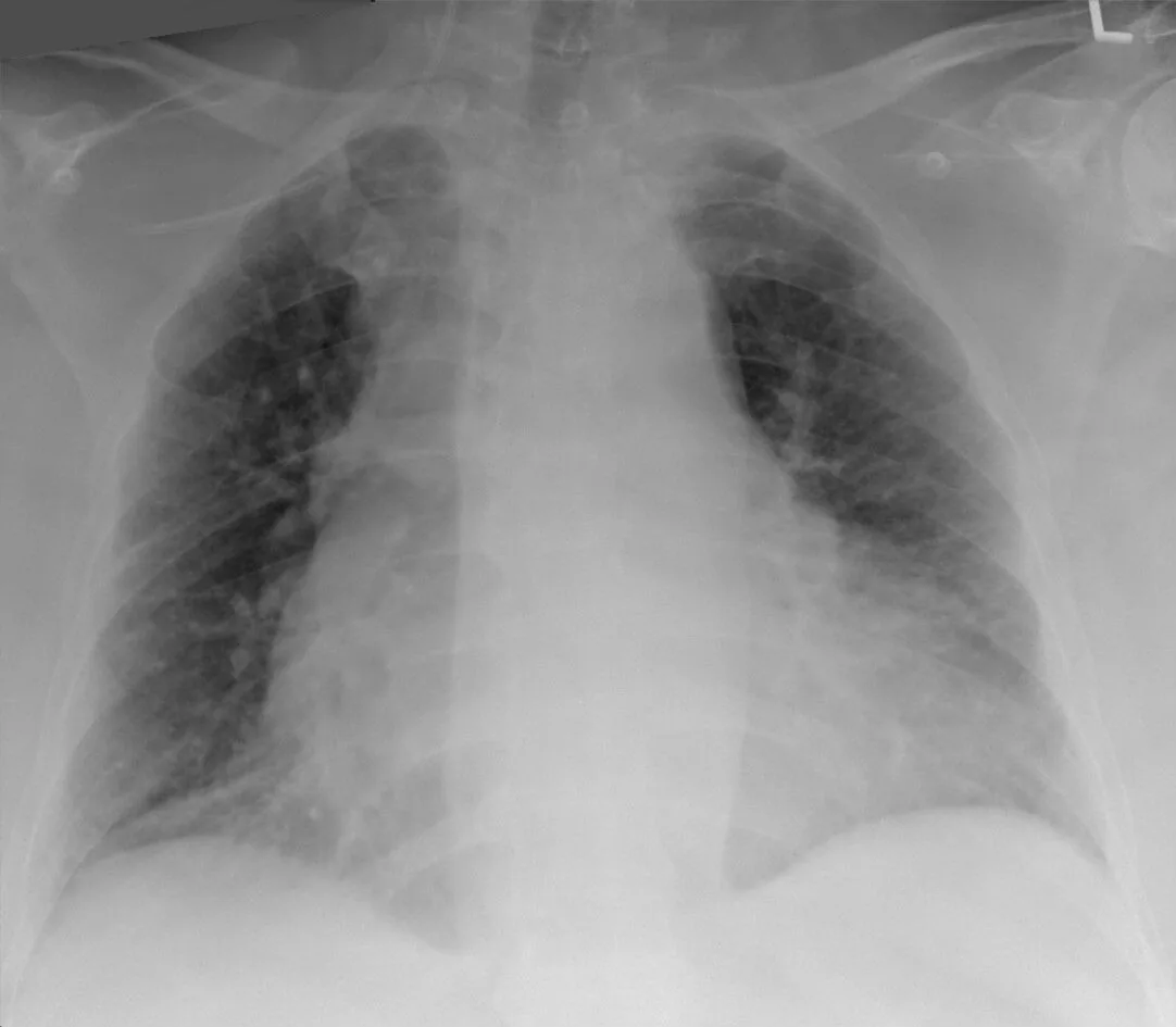 Lines & tubes radiograph for self-assessment