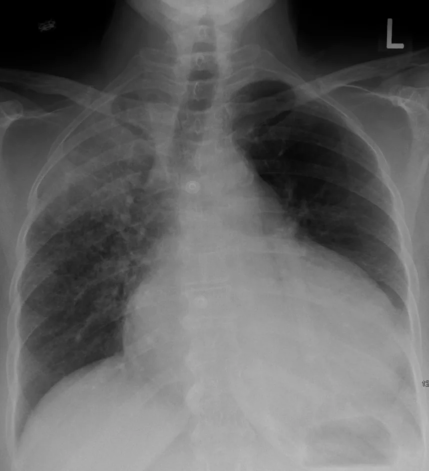 Chest radiograph for self-assessment