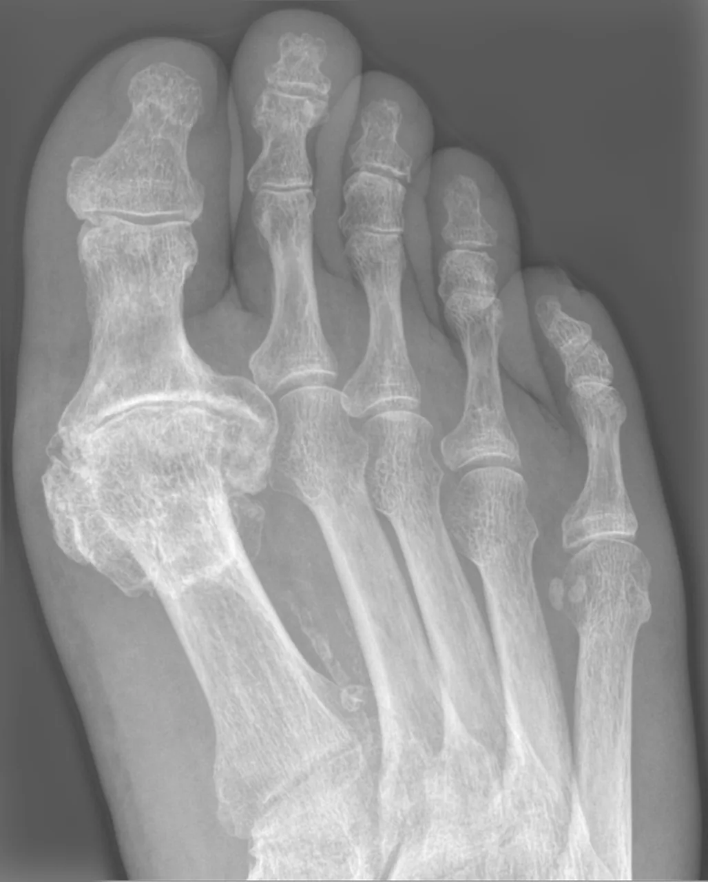 Bone & joint disease radiograph for self-assessment