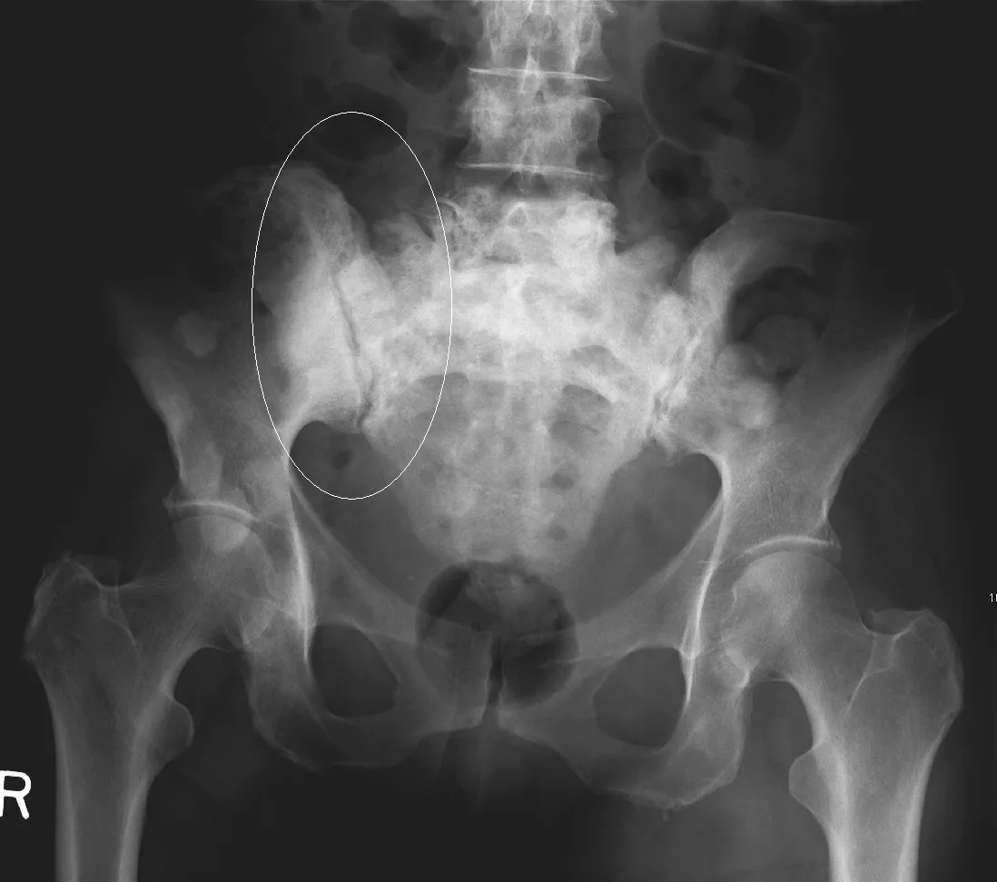 Bone & joint disease radiograph for self-assessment