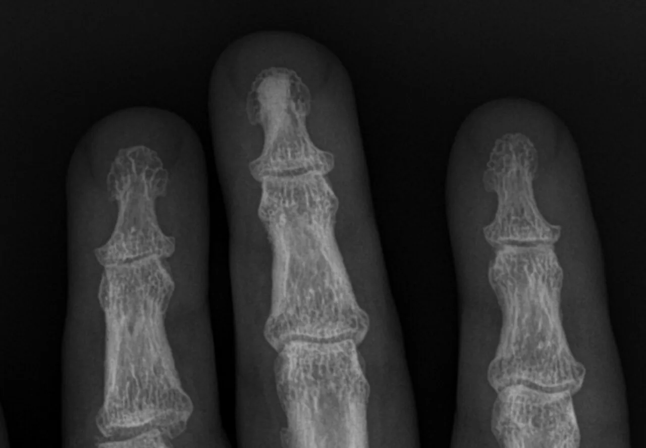Bone & joint disease radiograph for self-assessment