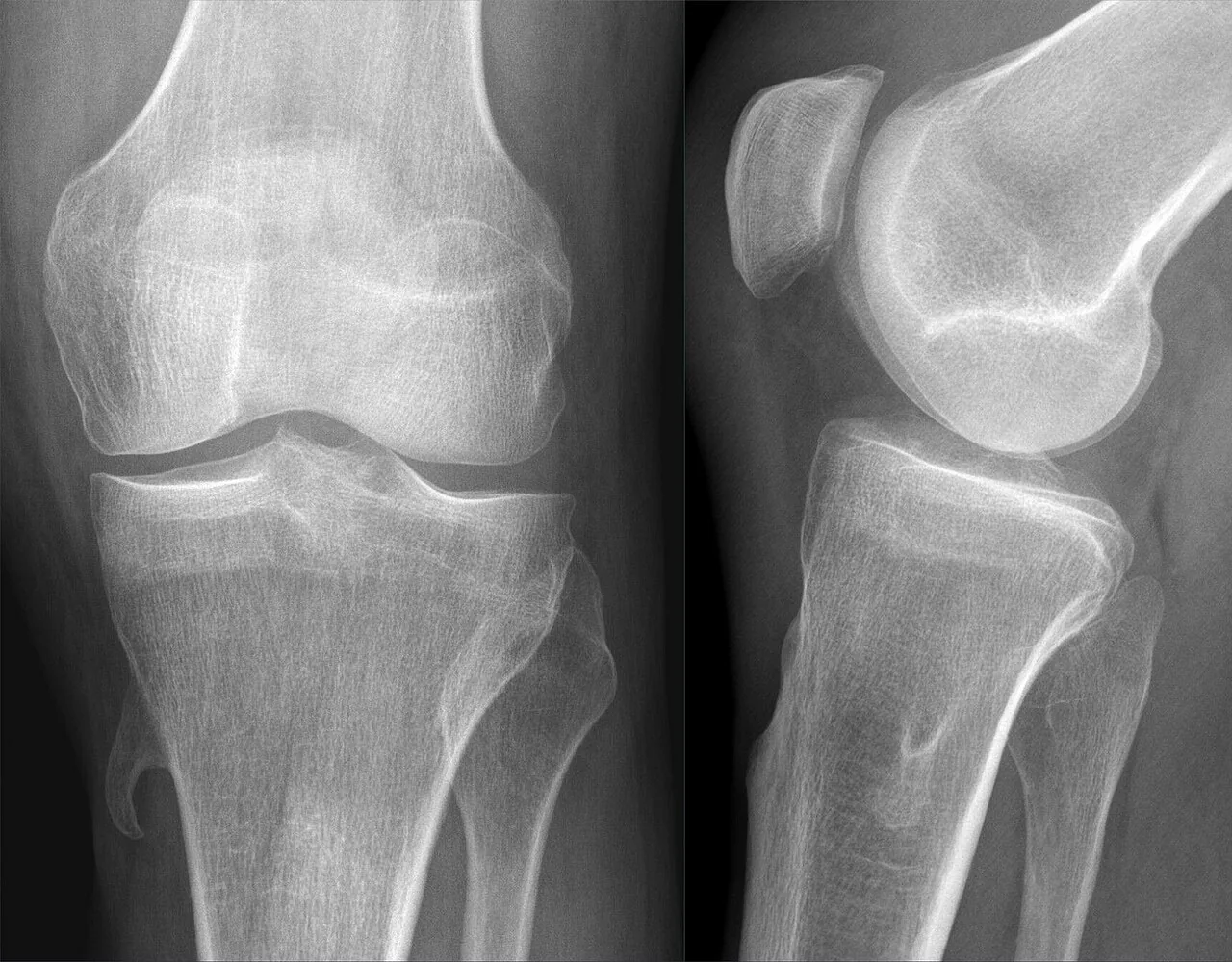 Bone & joint disease radiograph for self-assessment
