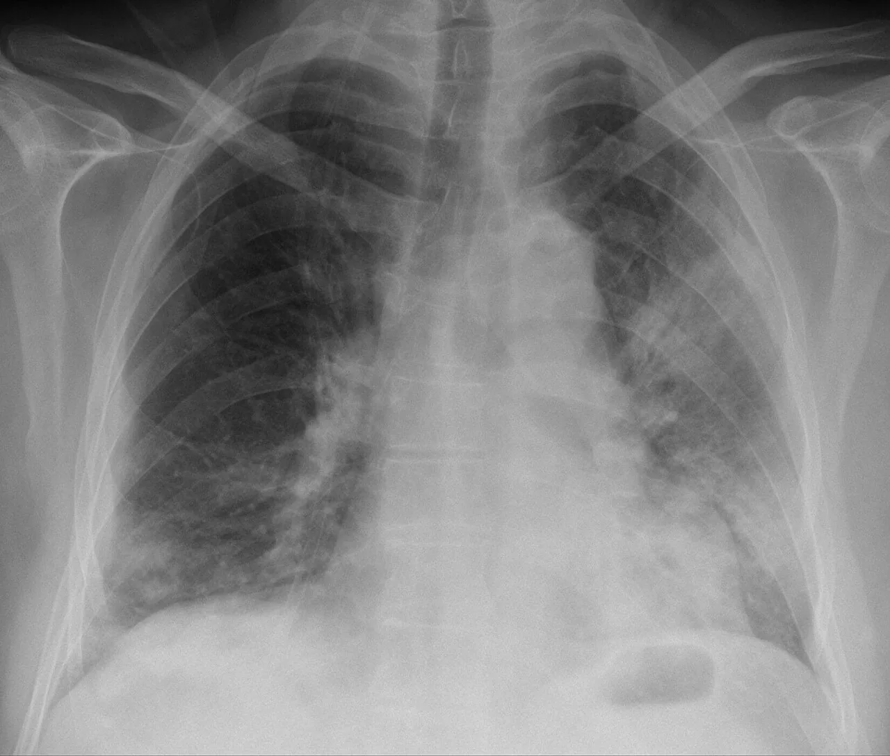 Chest radiograph for self-assessment