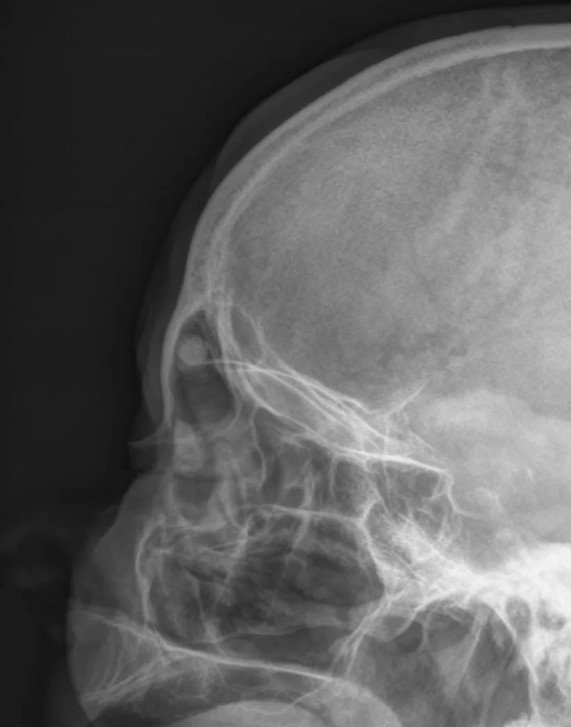 Bone & joint disease radiograph for self-assessment