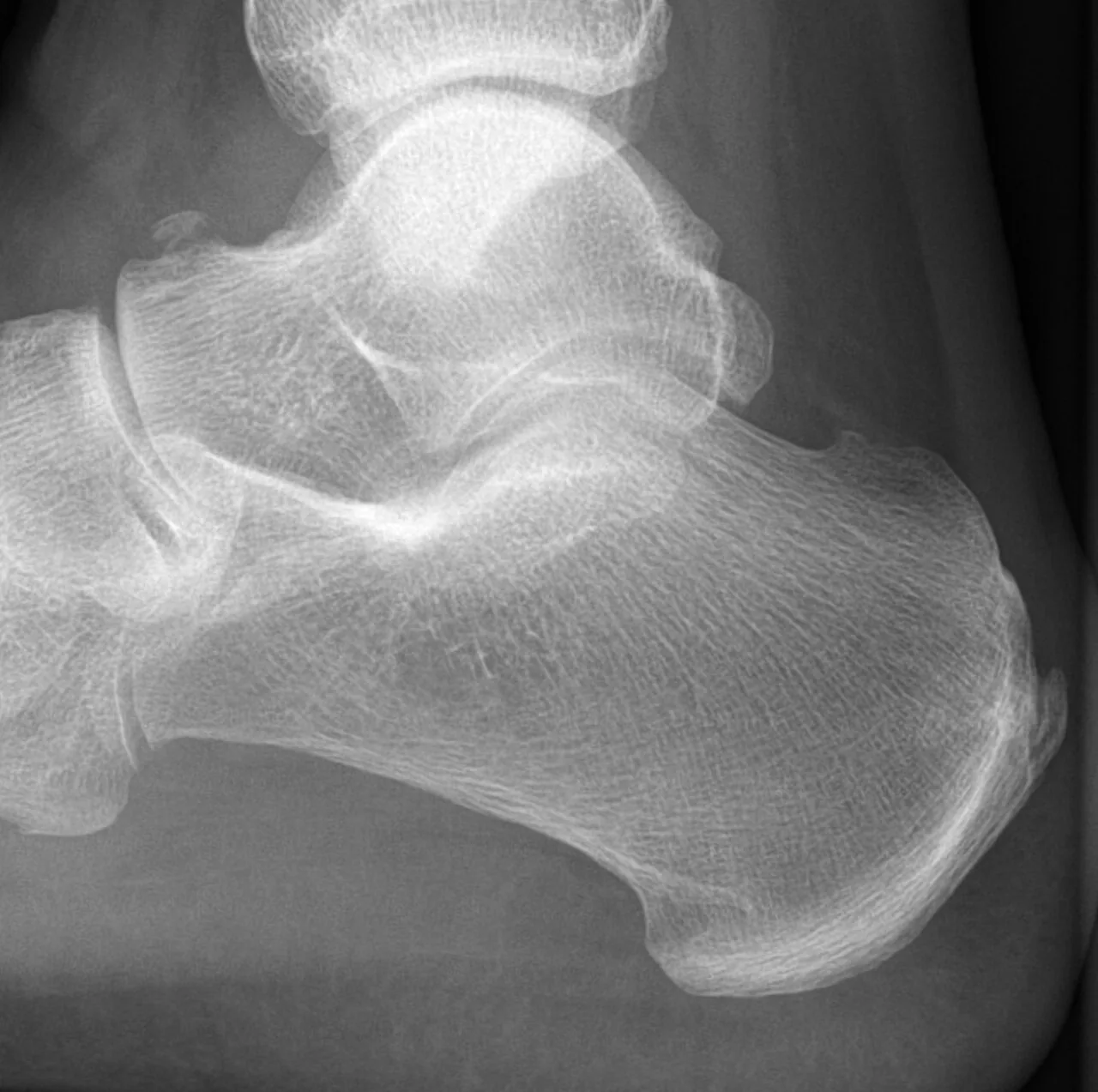 Lower limb radiograph for self-assessment