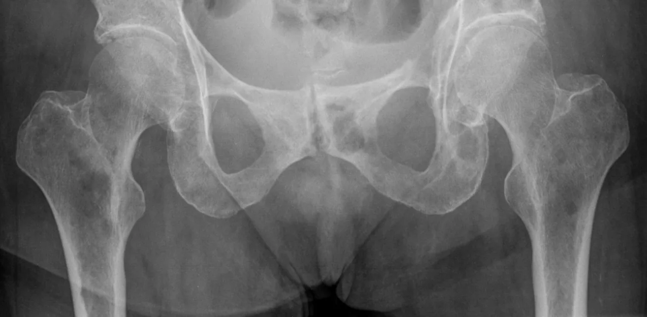 Bone & joint disease radiograph for self-assessment