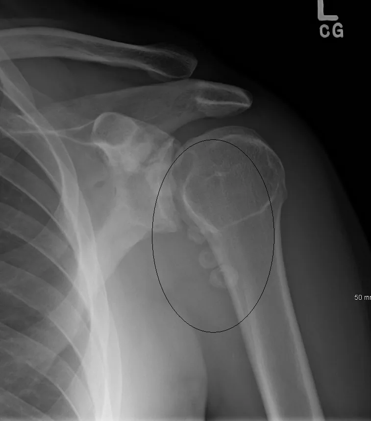 Upper limb radiograph for self-assessment