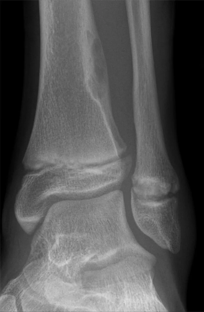 Bone & joint disease radiograph for self-assessment